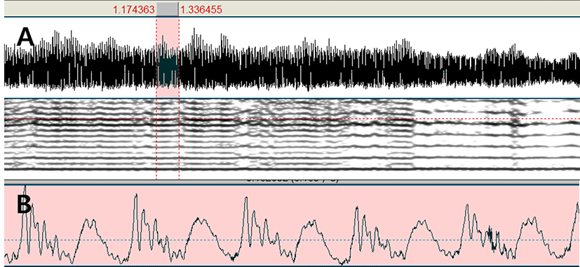 pss-10-1-75-g2