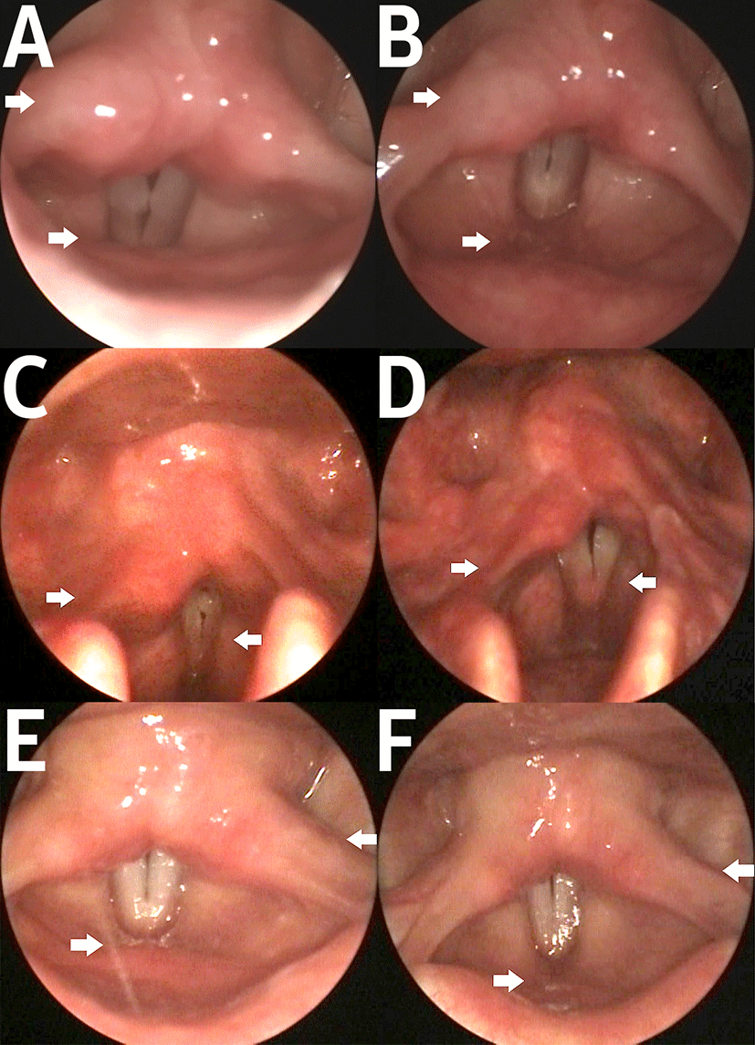 pss-10-4-155-g1