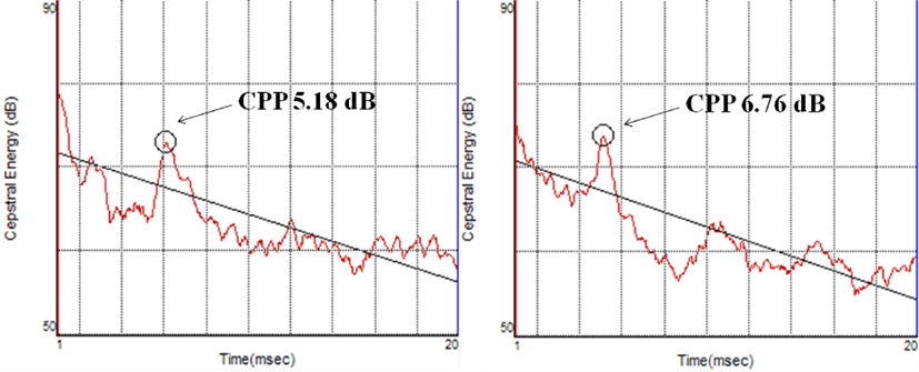 pss-12-4-91-g1